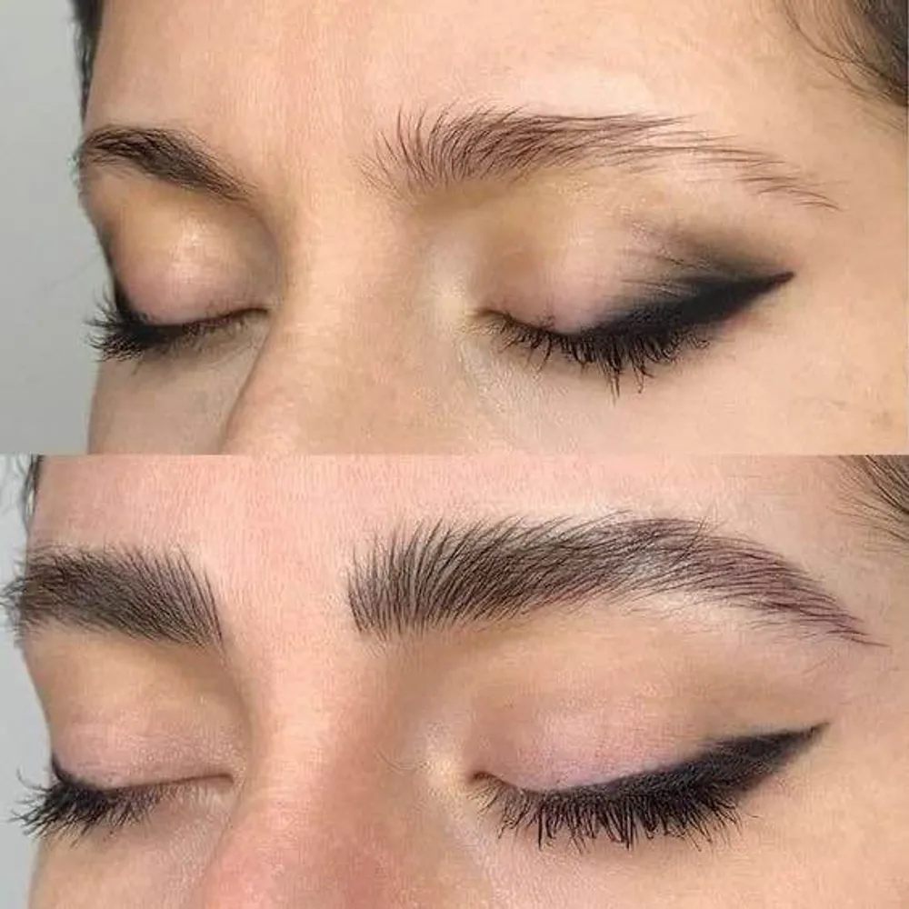 میکروبلیدینگ سوپرنچرال ابرو