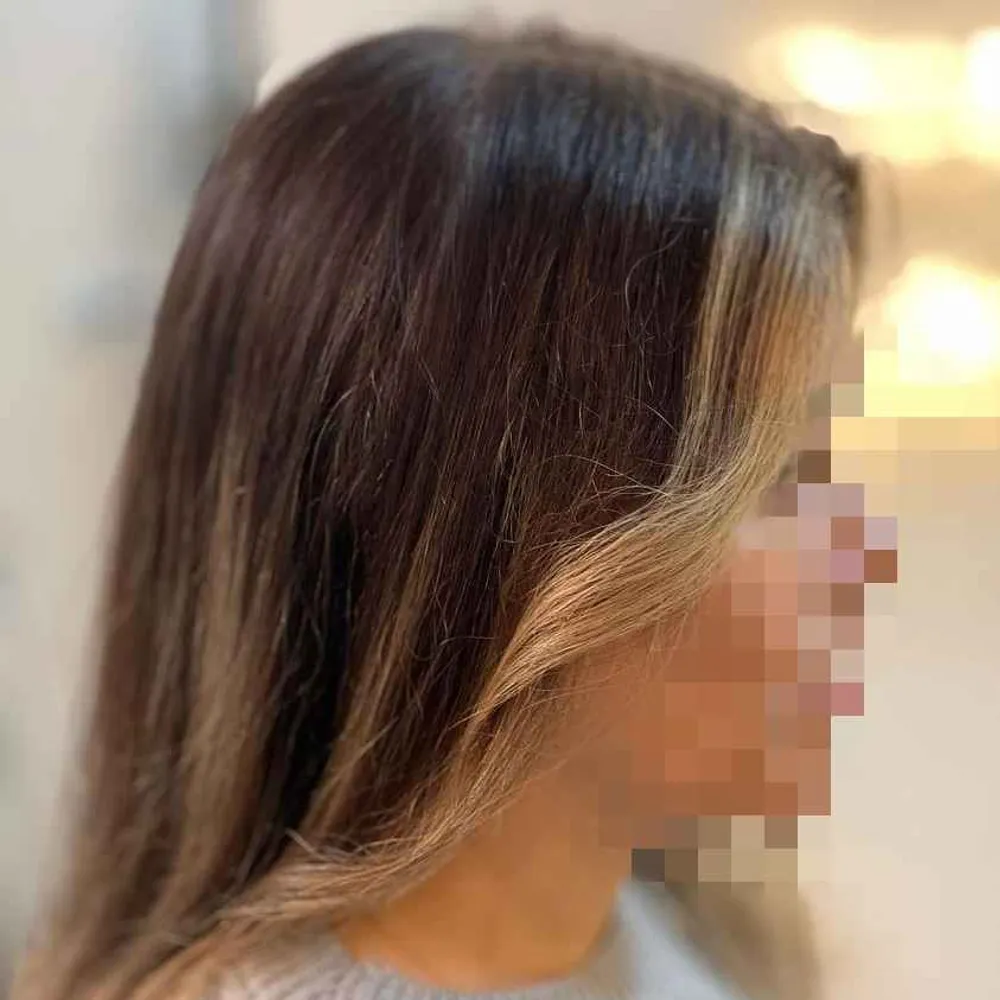 ترمیم لایت ده فویله