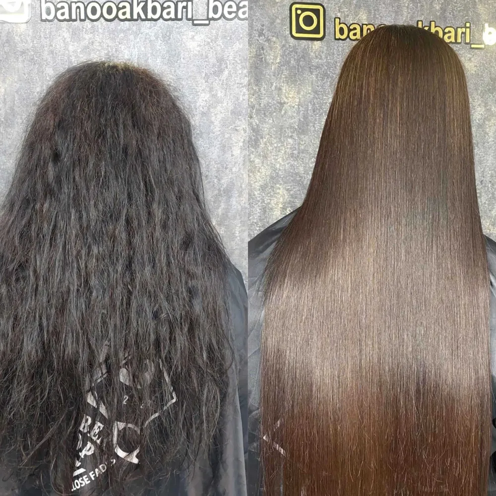 پروتئین تراپی 