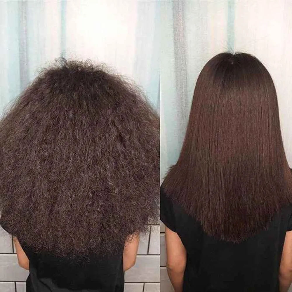 خاویار تراپی