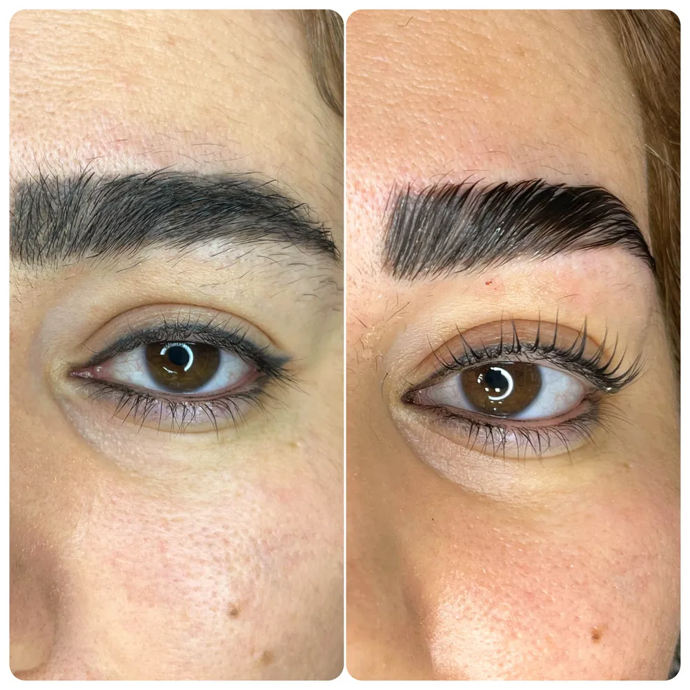 لیفت ابرو و مژه