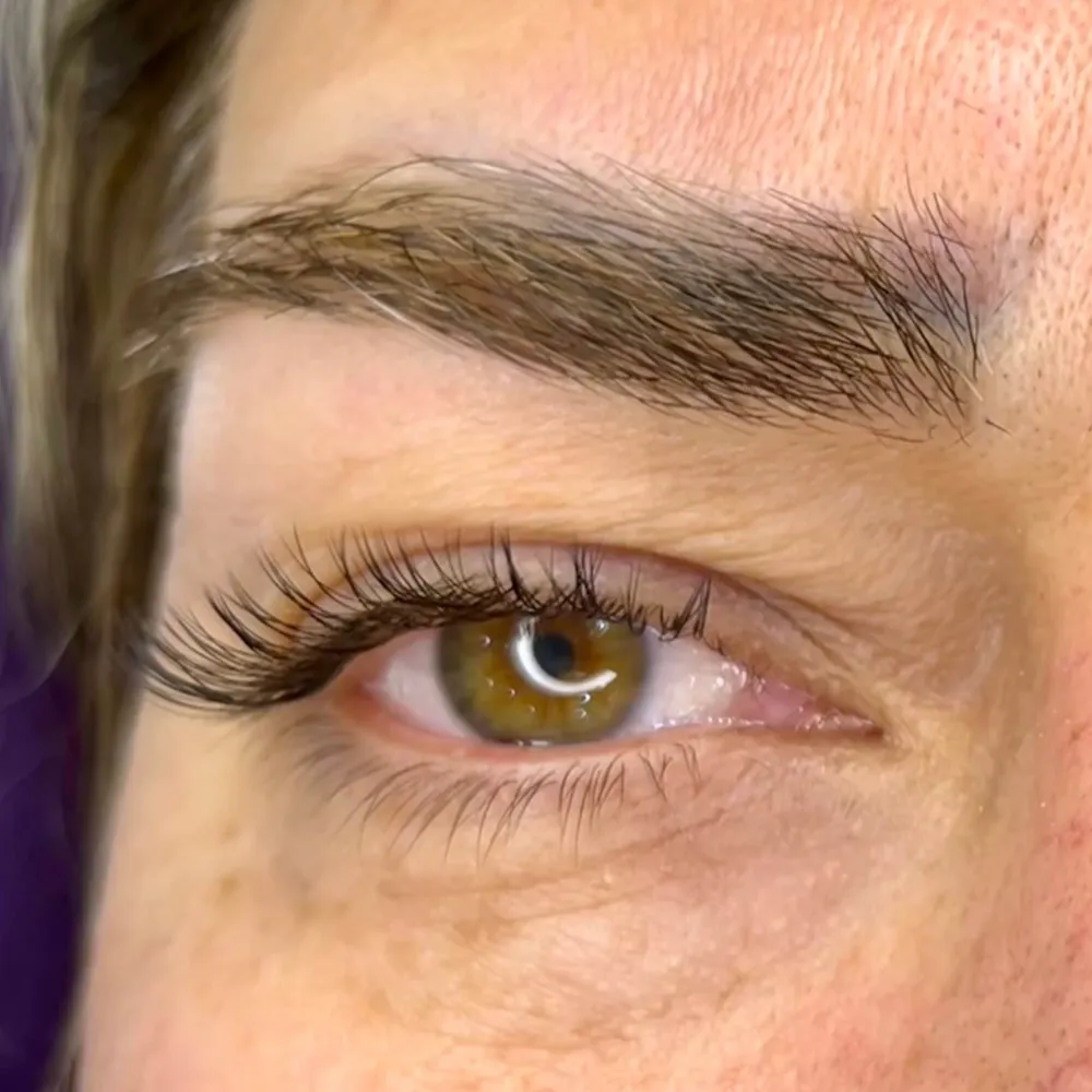 اکستنشن کلاسیک