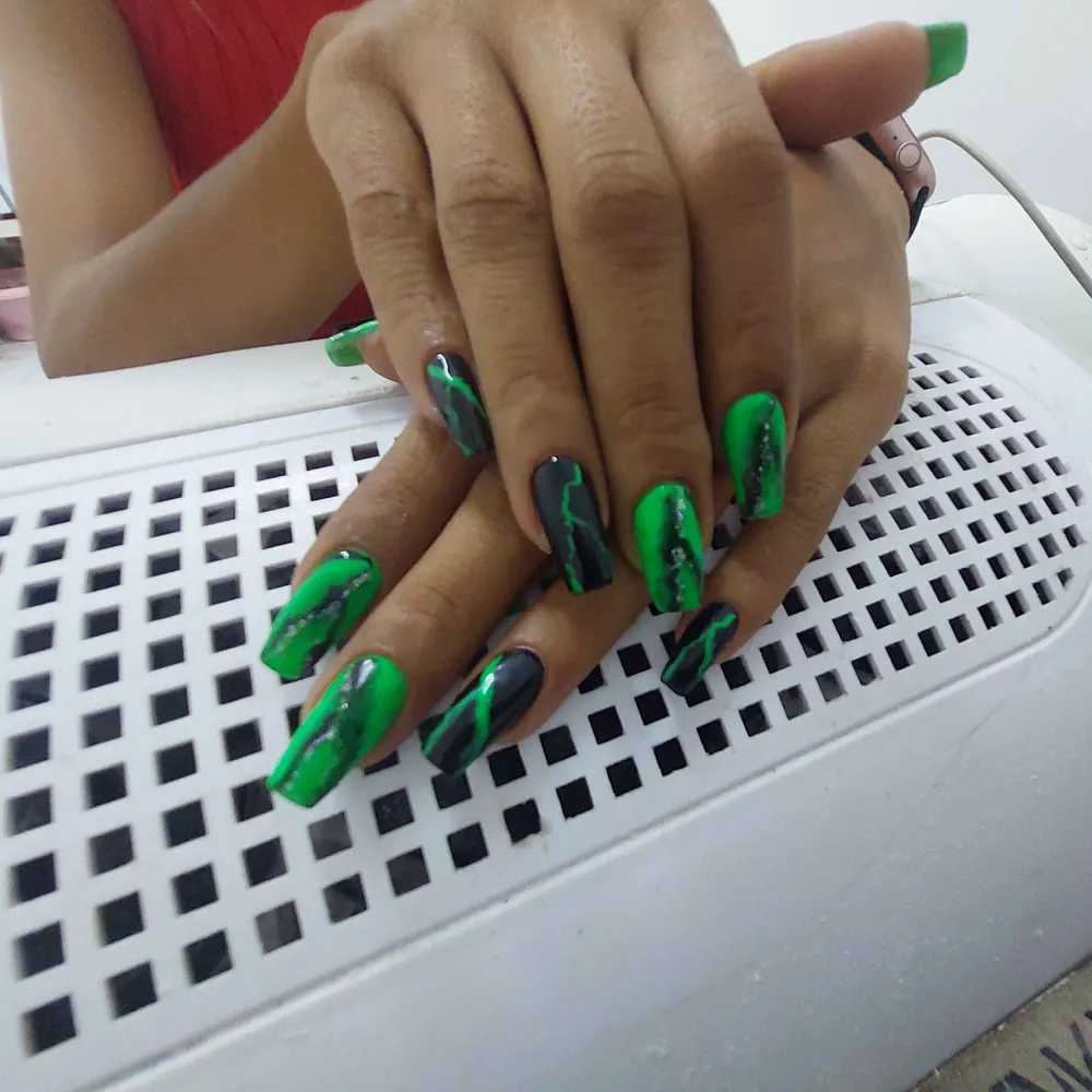 بعد از ترمیم