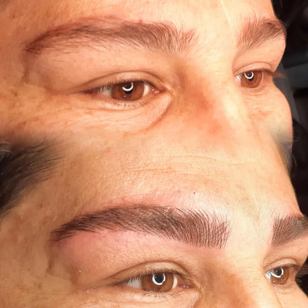 هاشور میکروبلیدینگ