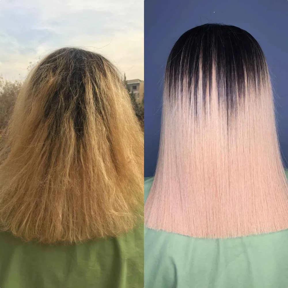 پروتئین تراپی