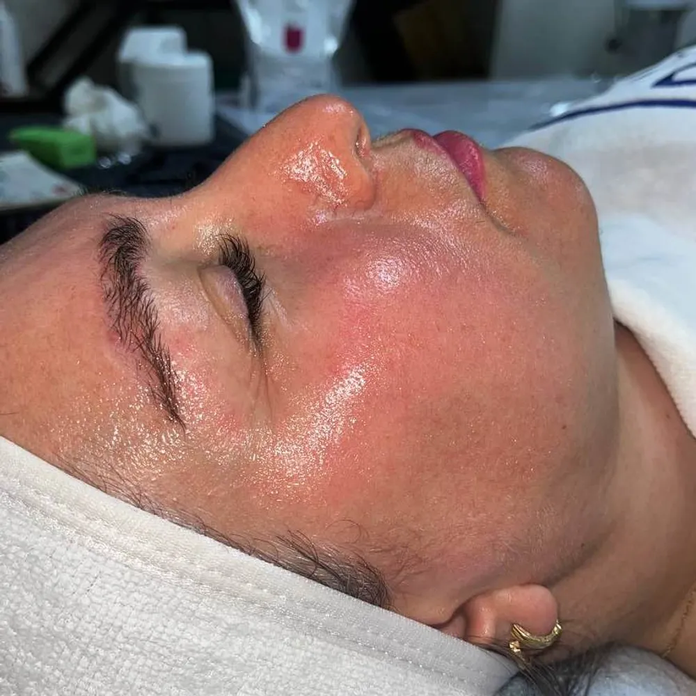 فیشال با روش های غیر تهاجمی 