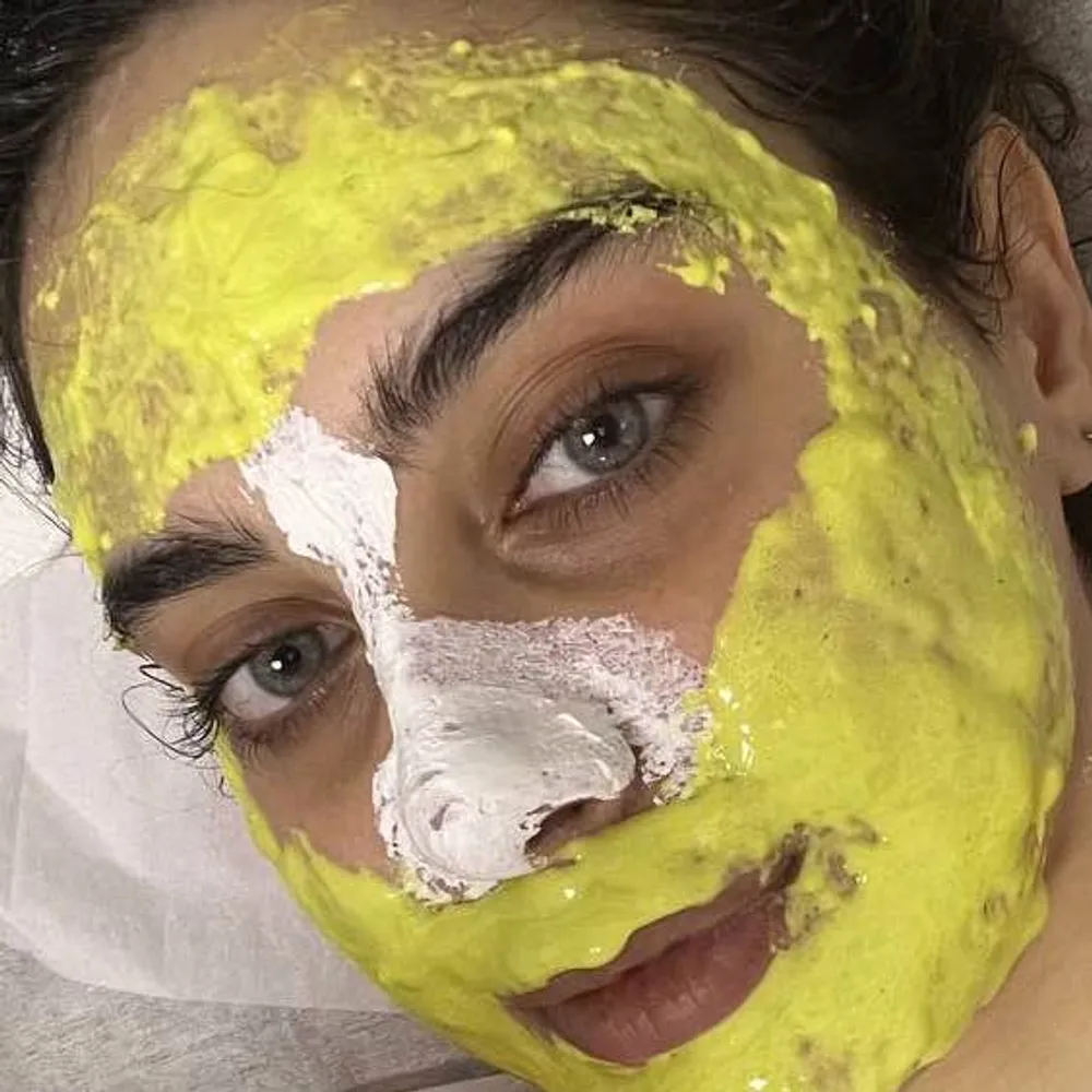 درمان آکنه های شدید التهابی 