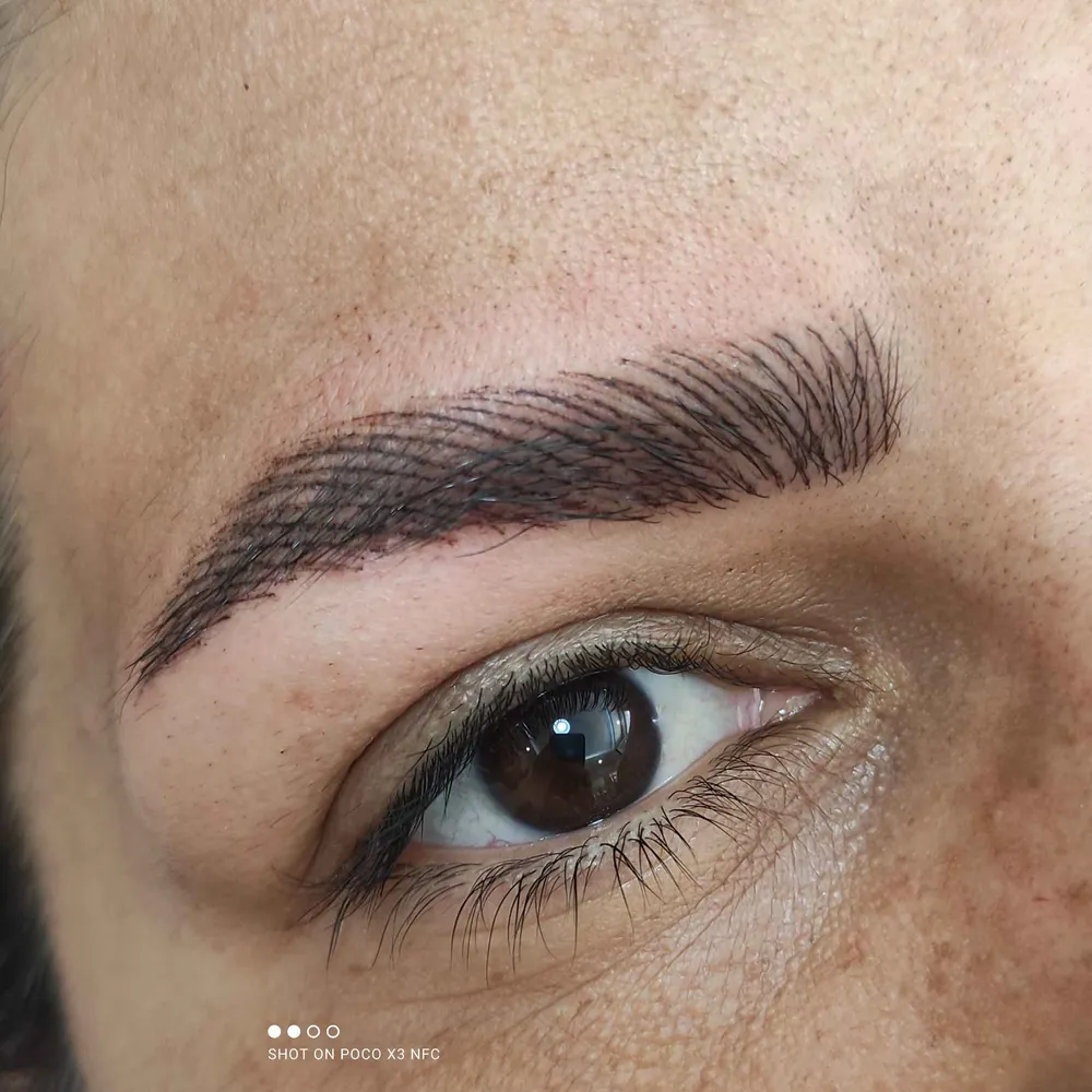 فیبروز ابرو 