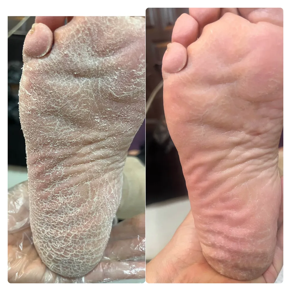 پدیکور کفسابی