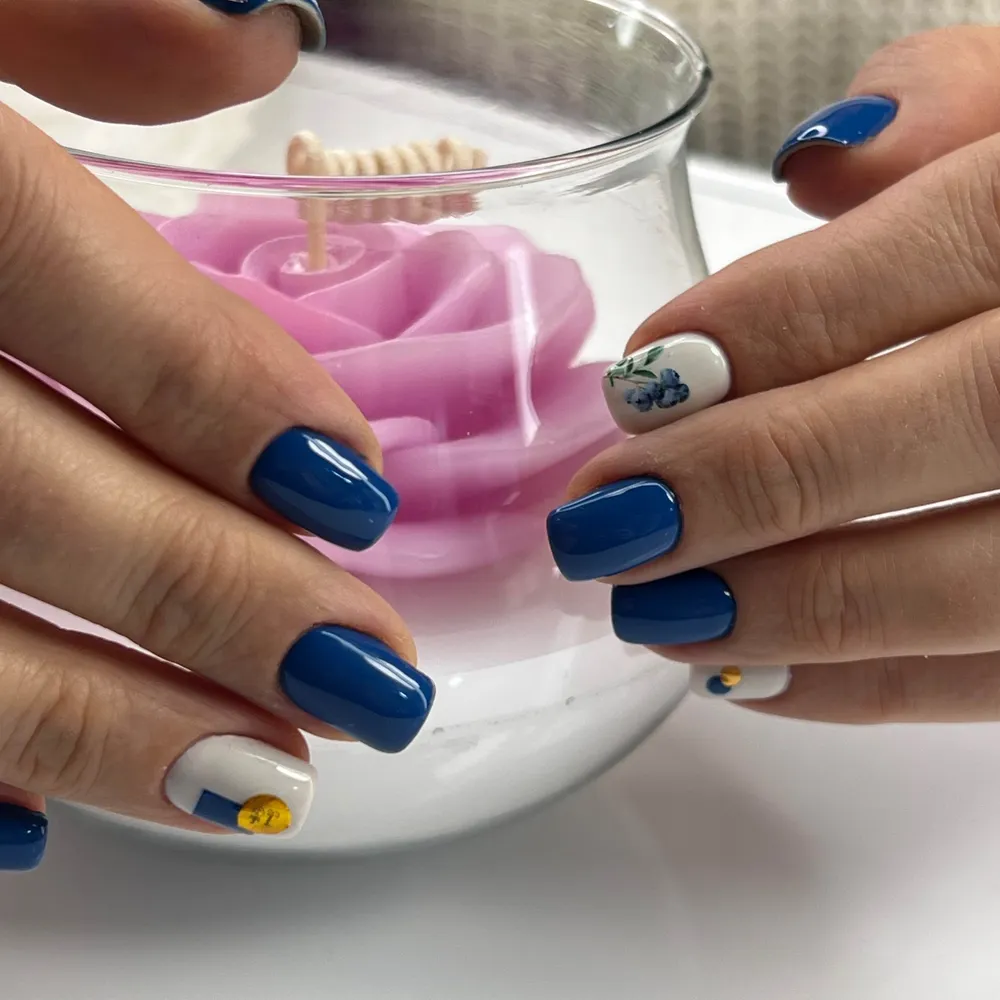 لمینت و لنز