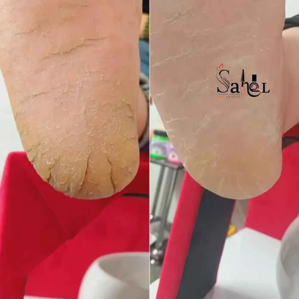 پدیکور کفسابی پا