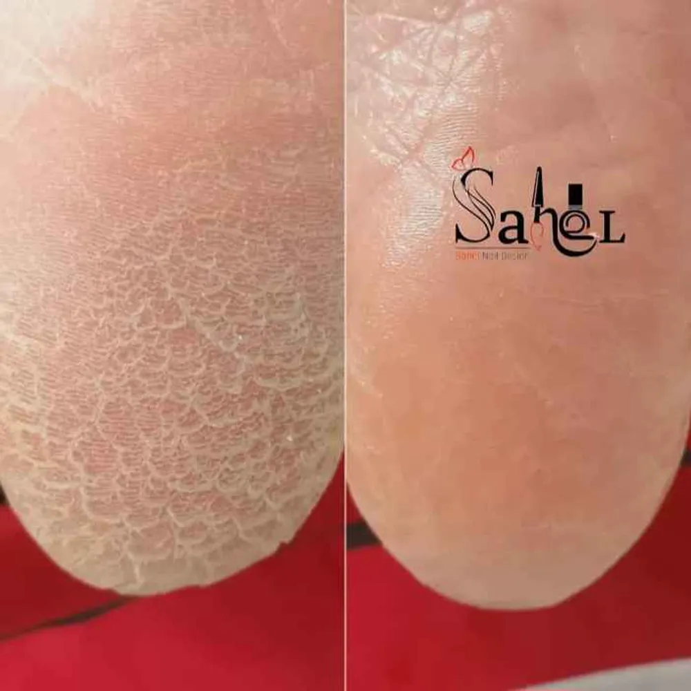 پدیکور کفسابی پا