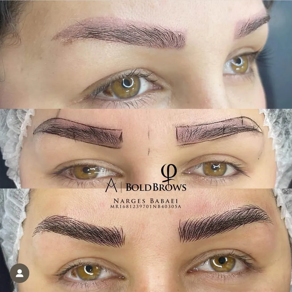 میکروبلیدینگ