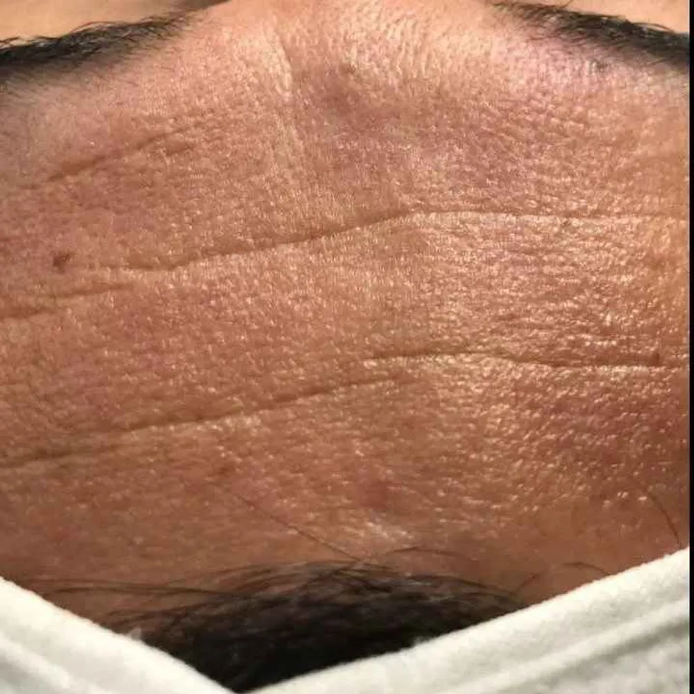 یه قبل و بعد 