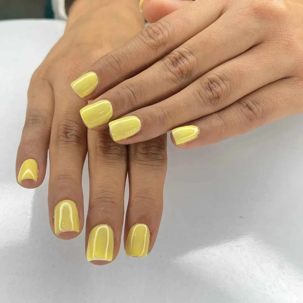 کاشت ولمینت