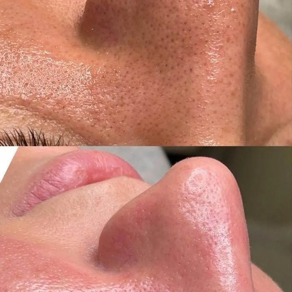 پاکسازی و فیشیال پوست