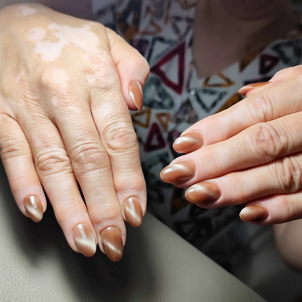 آیس سرامیکی 