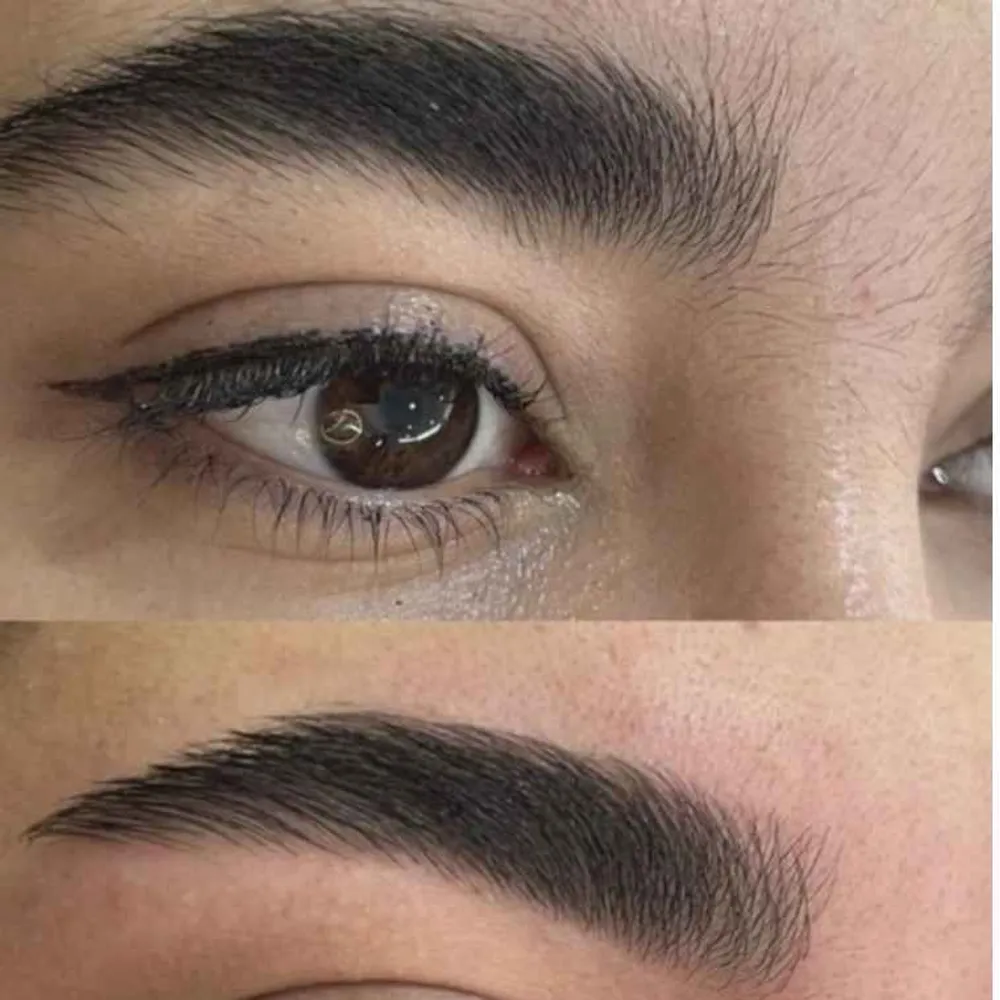 اصلاح ابرونچرال