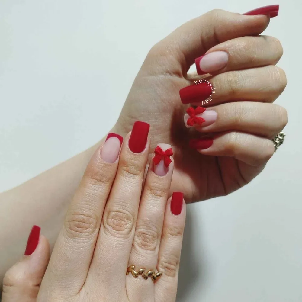 کاشت ژل با دیزایین پاپیون 