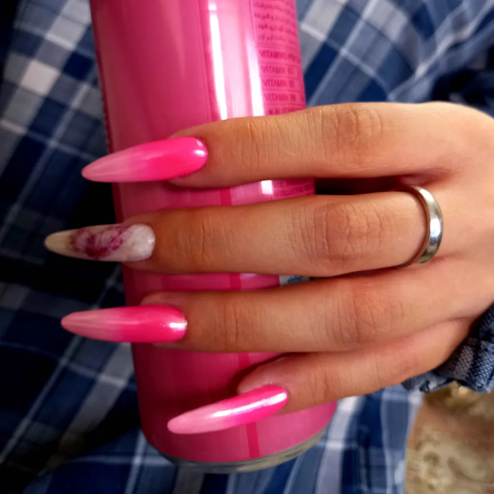 کاشت ژورنالی 