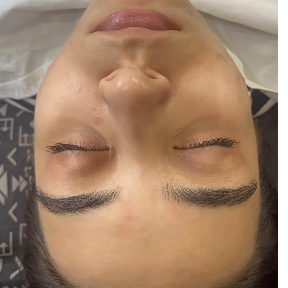 پاکسازی پوست 