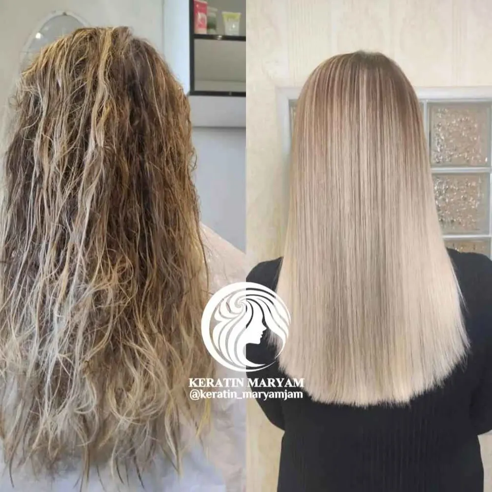 آرژنین تراپی 