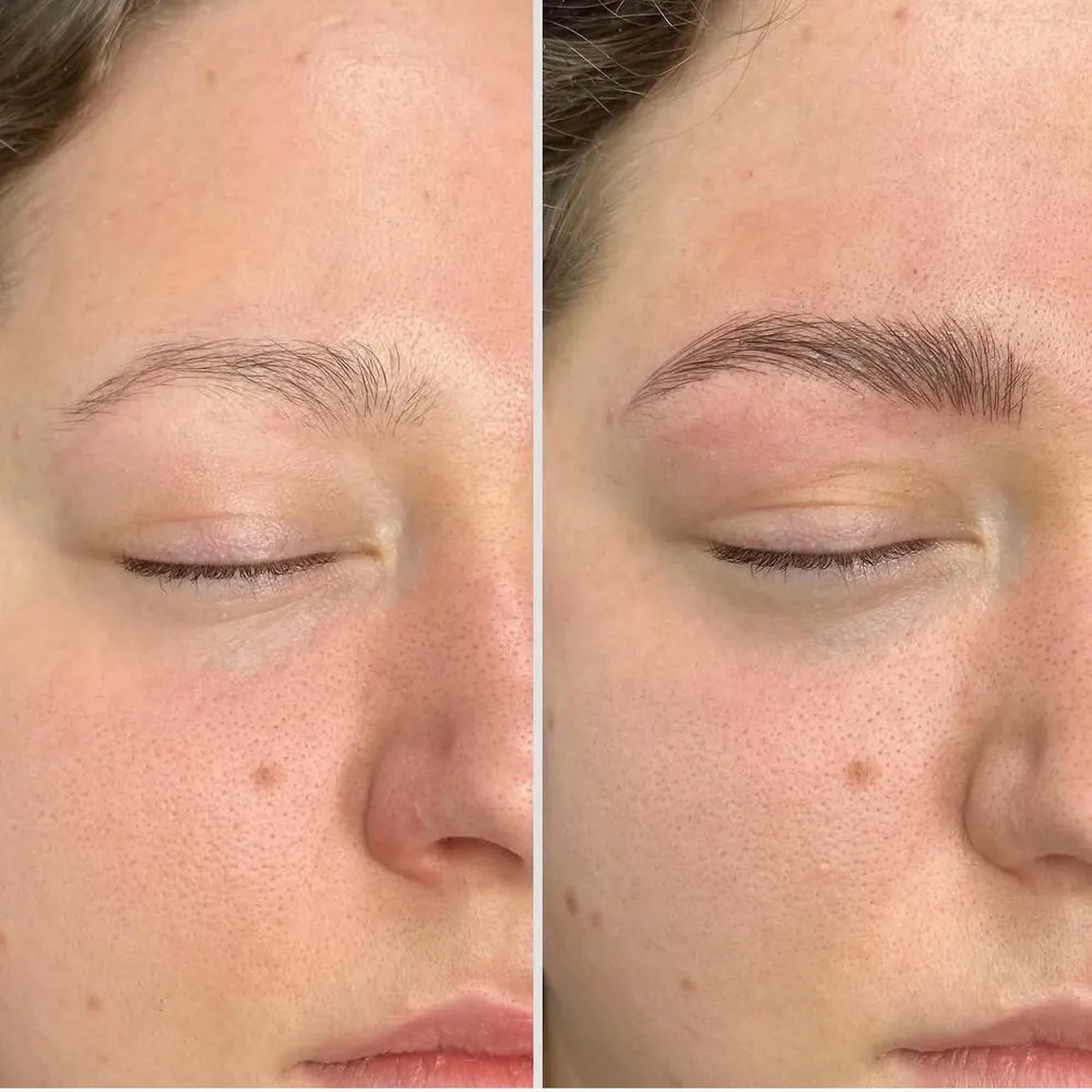 ميكروبلدينگ تكنيك انحصاري موربروز 