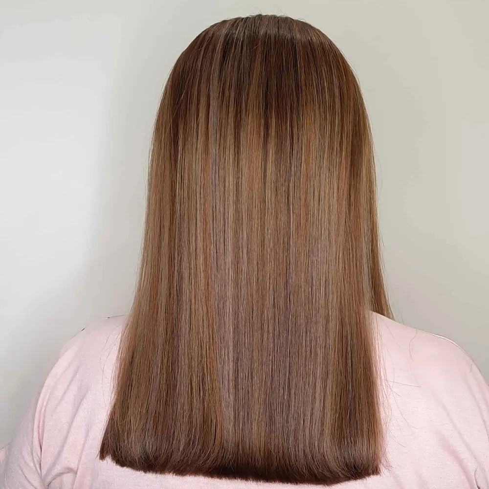 بوتاکس و احیا دکلره 