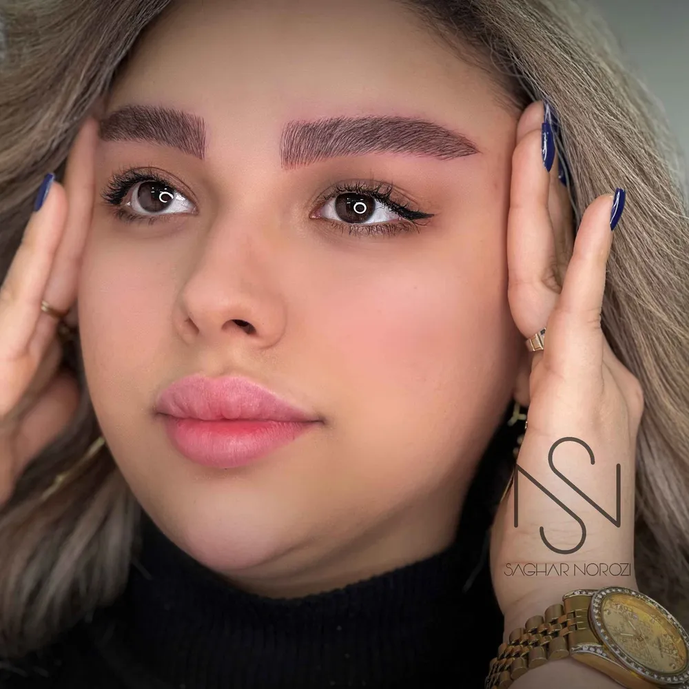 میکروبلیدینگ کرمی مویی