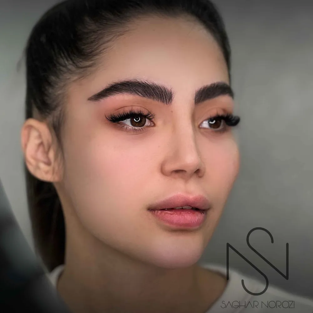 میکروبلیدینگ لیفت بروز 