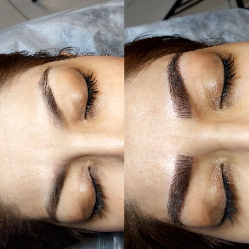 میکروبلیدینگ وطرح بدن