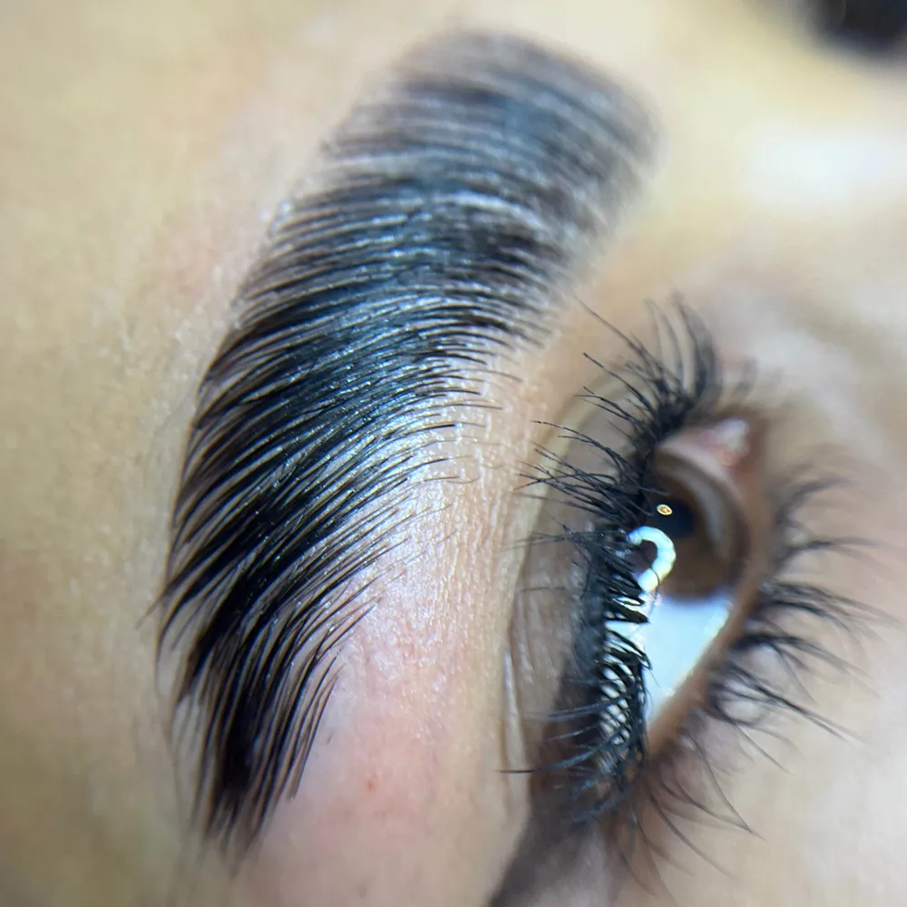 لیفت و بوتاکس تراپی ابرو