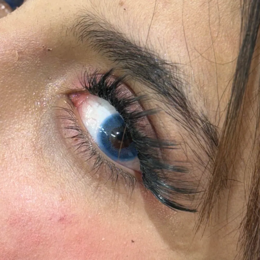 کاشت مژه هیدن