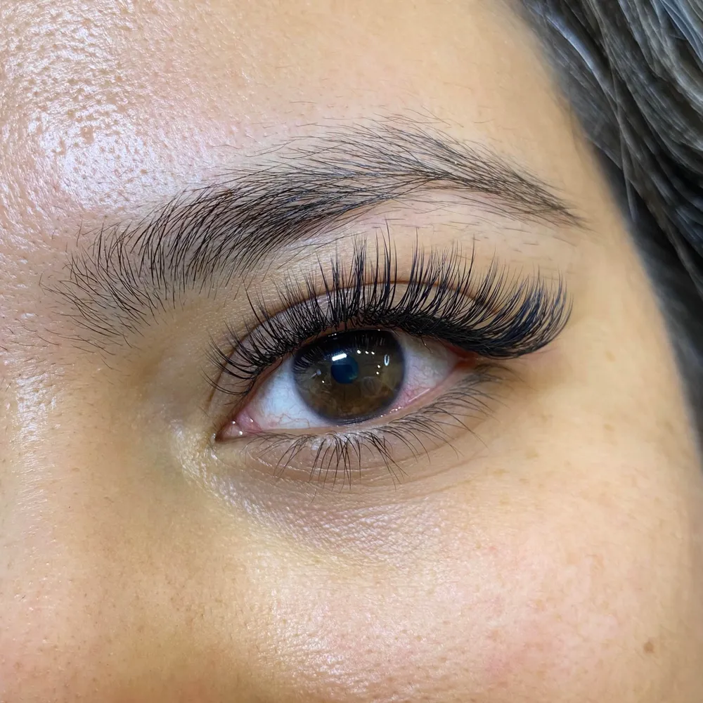 کاشت اسپایکی