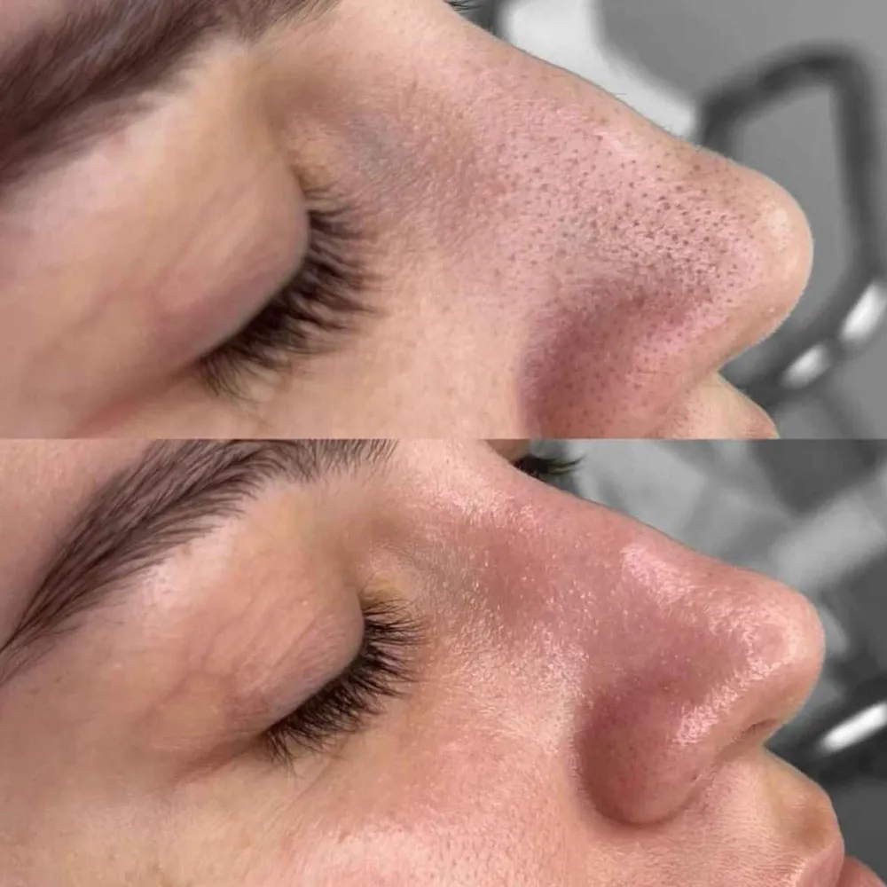 فیشال تخصصی 