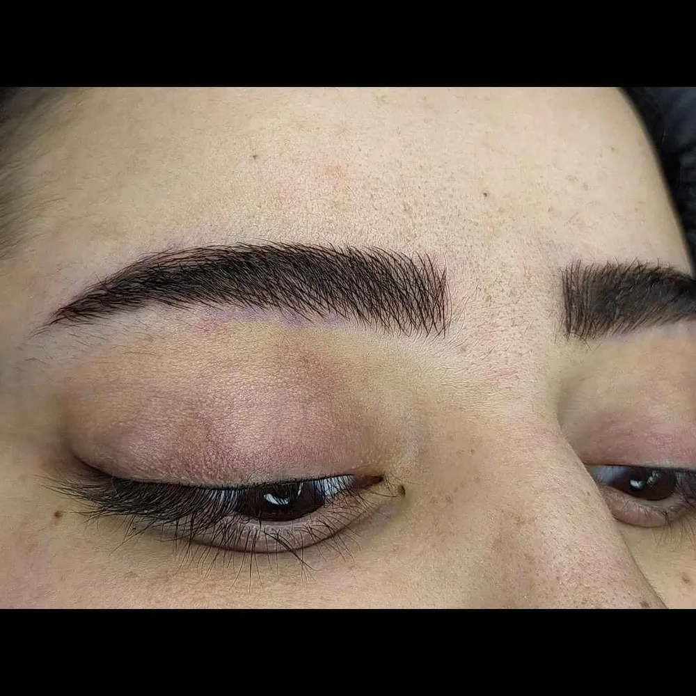 فیبروز ابرو 