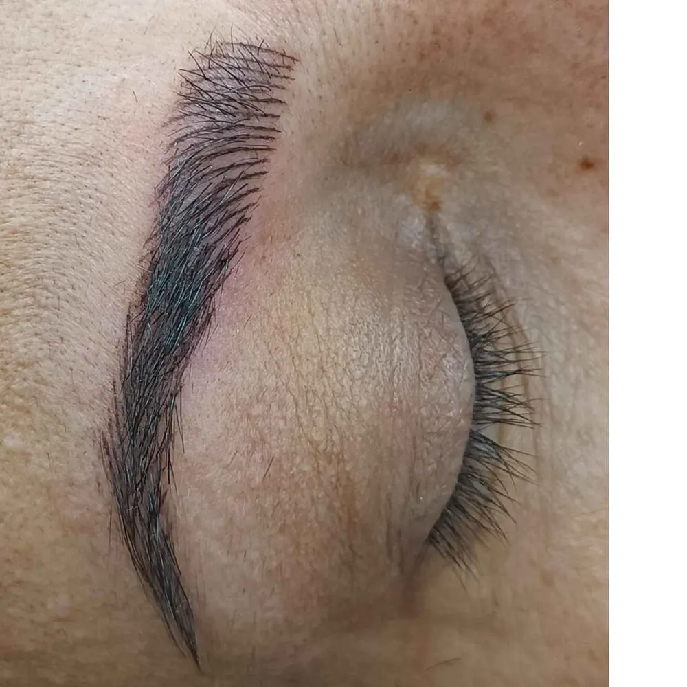 میکروبلیدینگ 