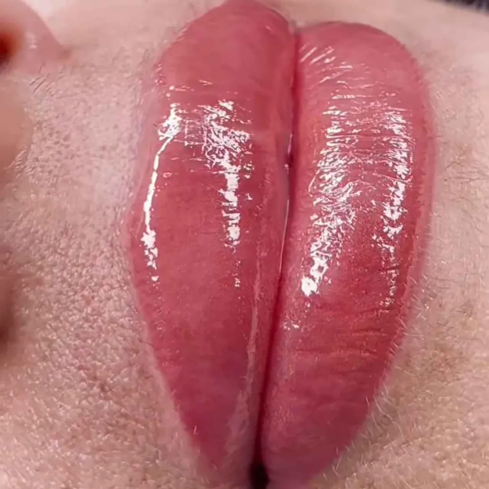 میکروبلیدینگ و میکروپیگمنتیشن