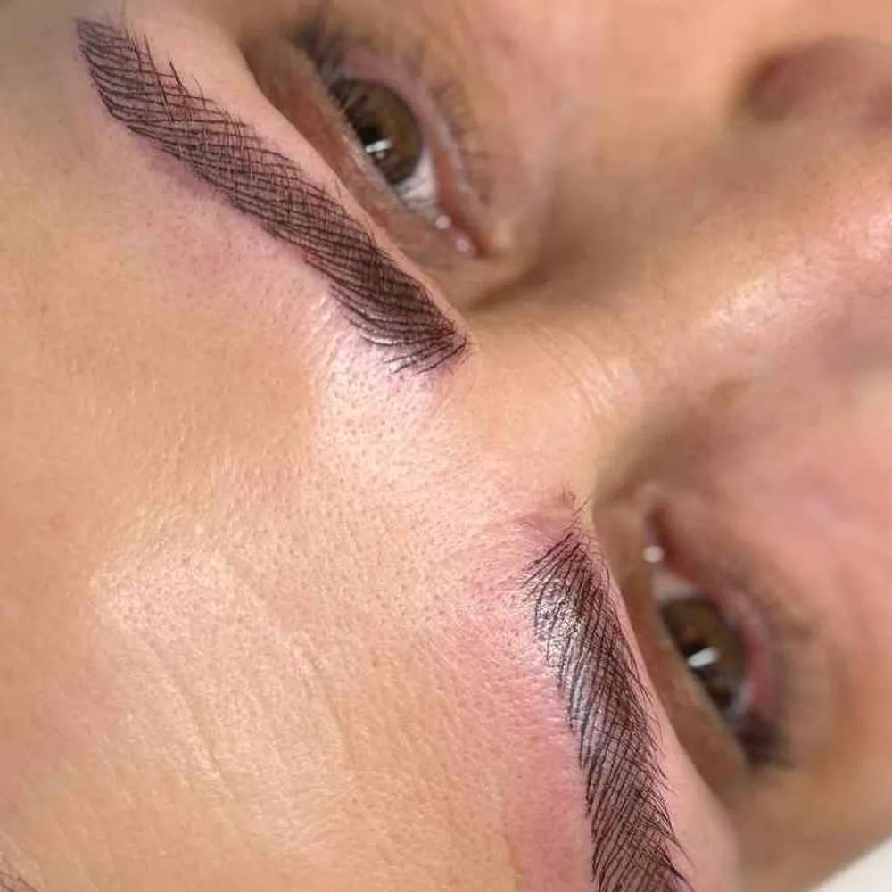 میکروپیگمنتیشن