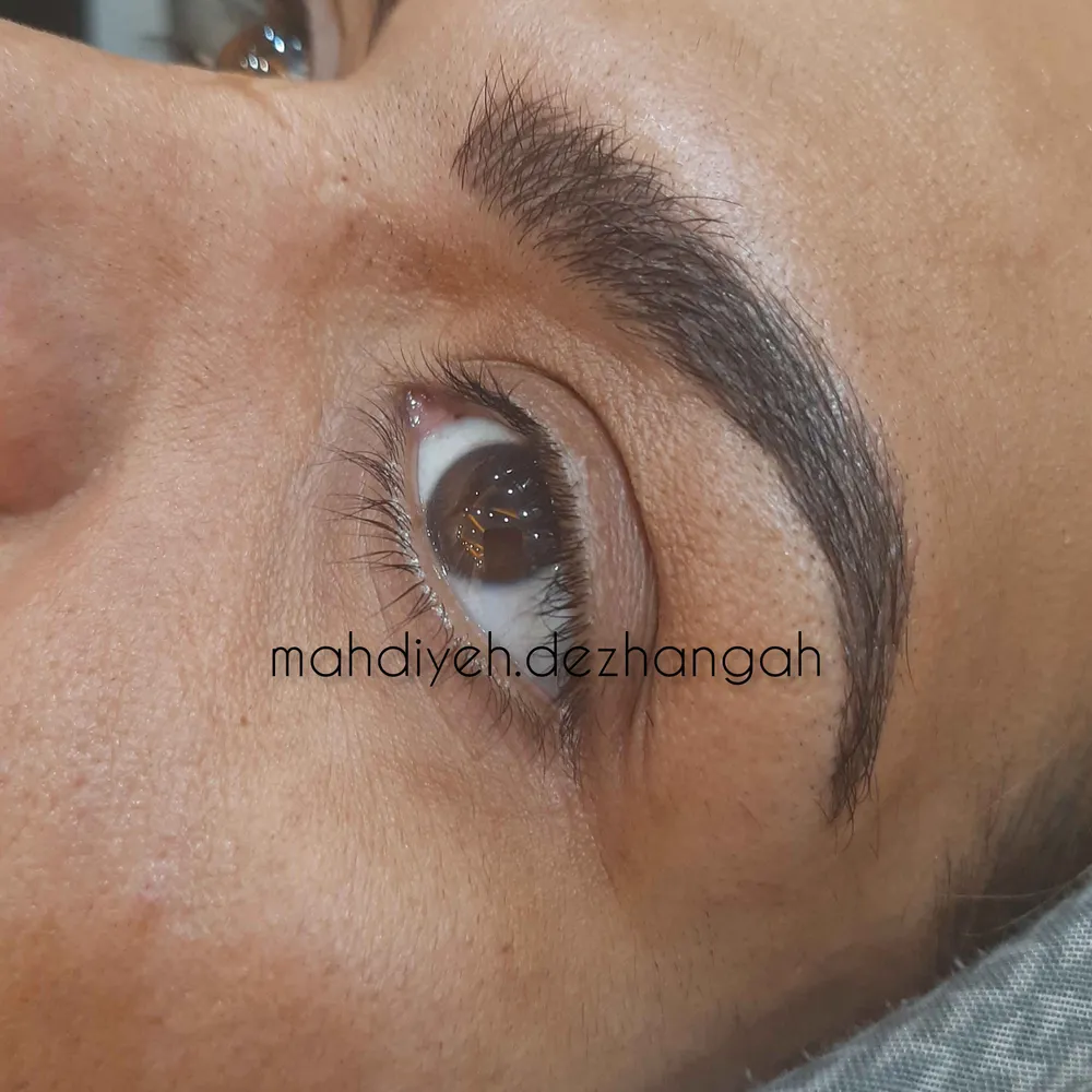 فیبروز ابرو