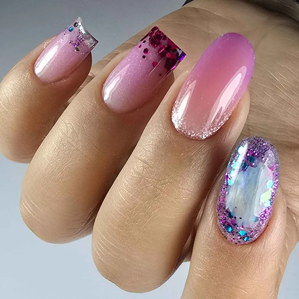 کاشت قالب ،آمبره ی روسی ، کاور لمینیت 