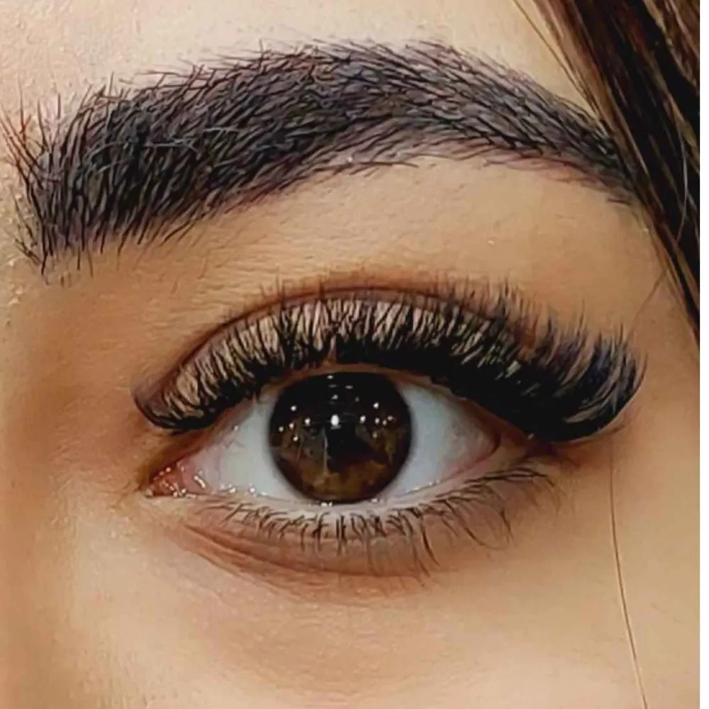 کاشت اکستنشن والیوم