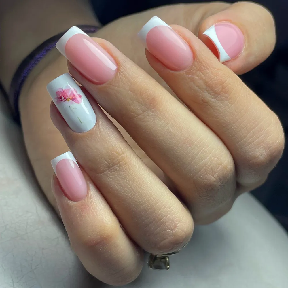 ترمیم لمینت