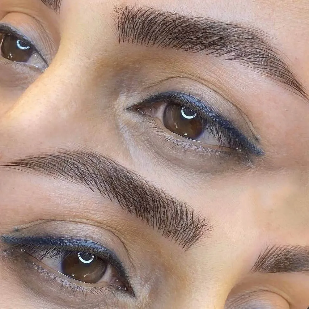 میکروبلیدینگ