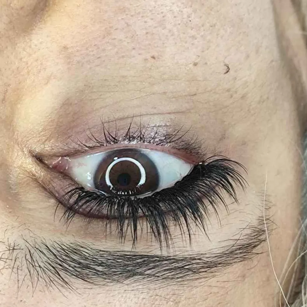 اکستنشن ربل