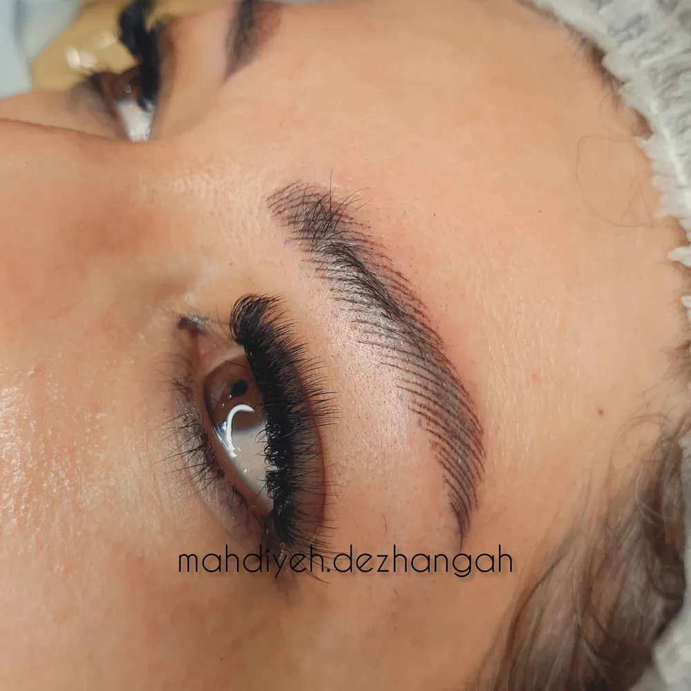 میکروپیگمنتیشن