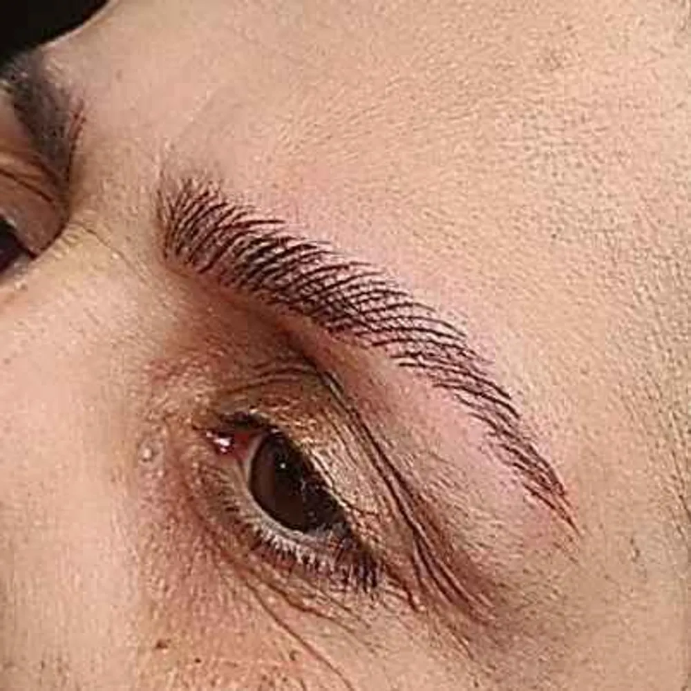 شیدلب.فیبروز