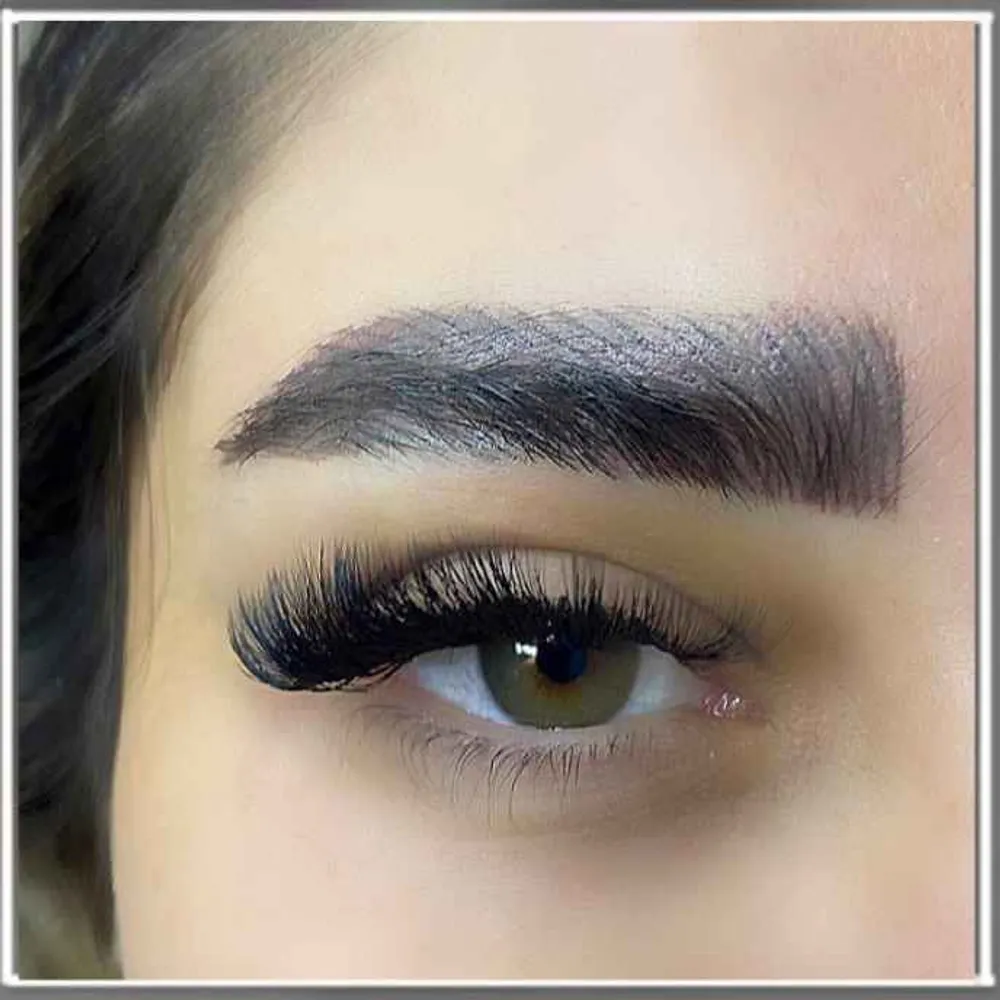 کاشت مگاوالیوم