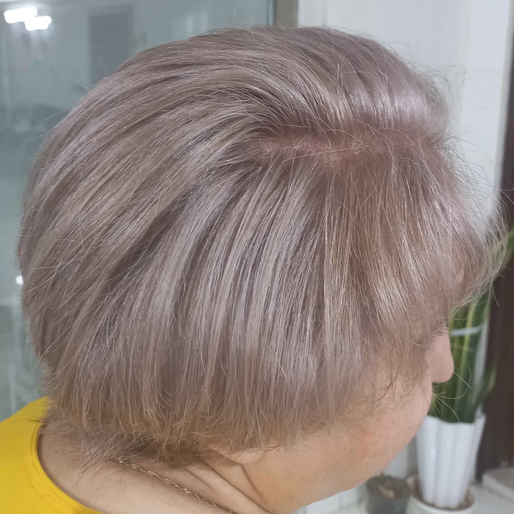 کوتاهی ، رنگ موی سفید 