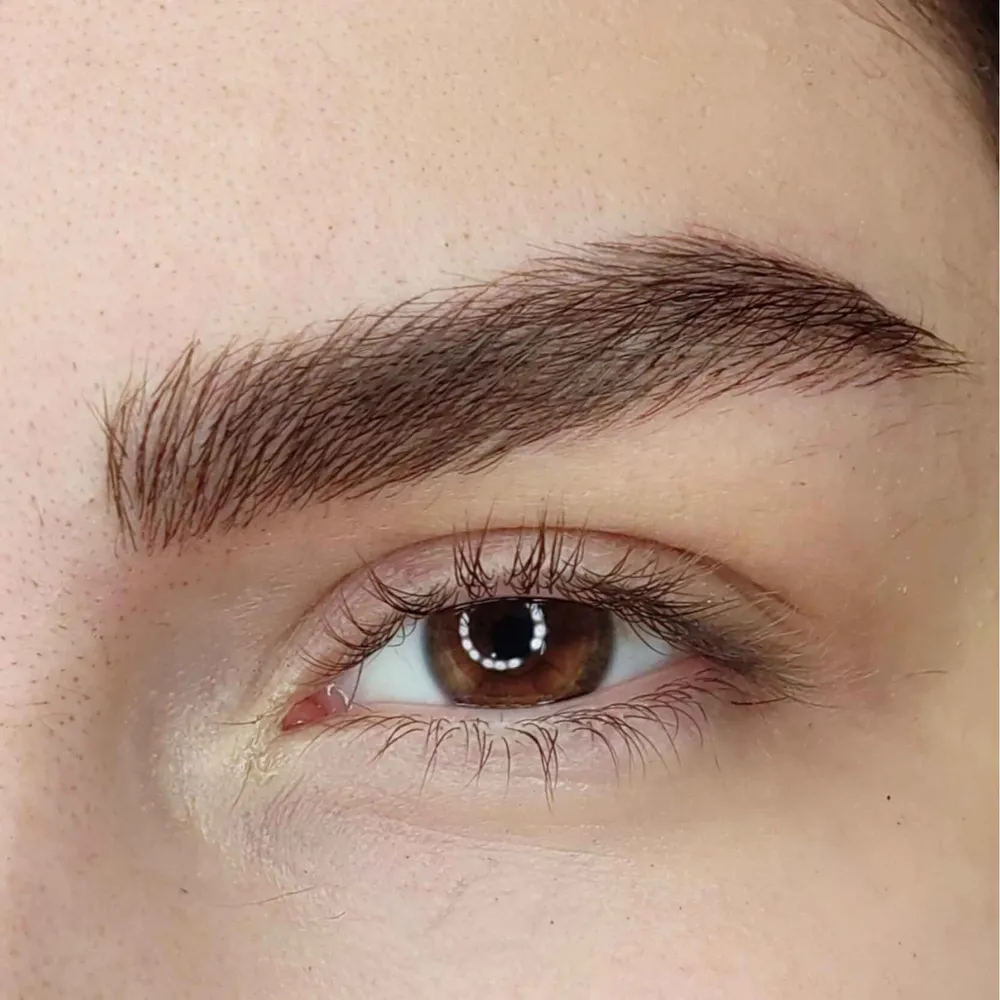 میکروبلیدینگ 